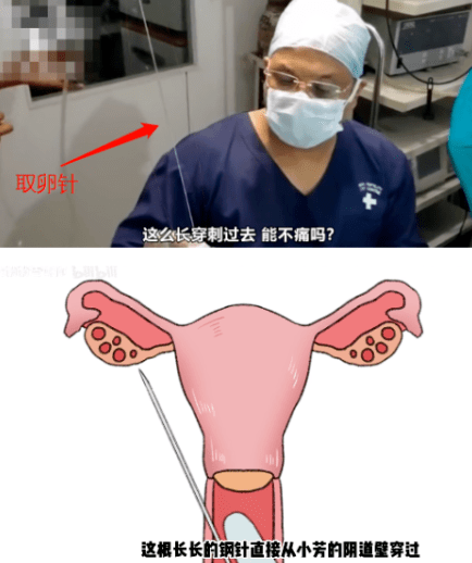 “五万一次<strong></p>
<p>交易性金融资产</strong>，刺穿下体”：比性交易更恐怖的是无性交易！