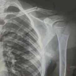 赤峰市教育局介入<strong></p>
<p>三角货币对冲指标</strong>，家长称：孩子拨弄开关被另一班班主任打伤