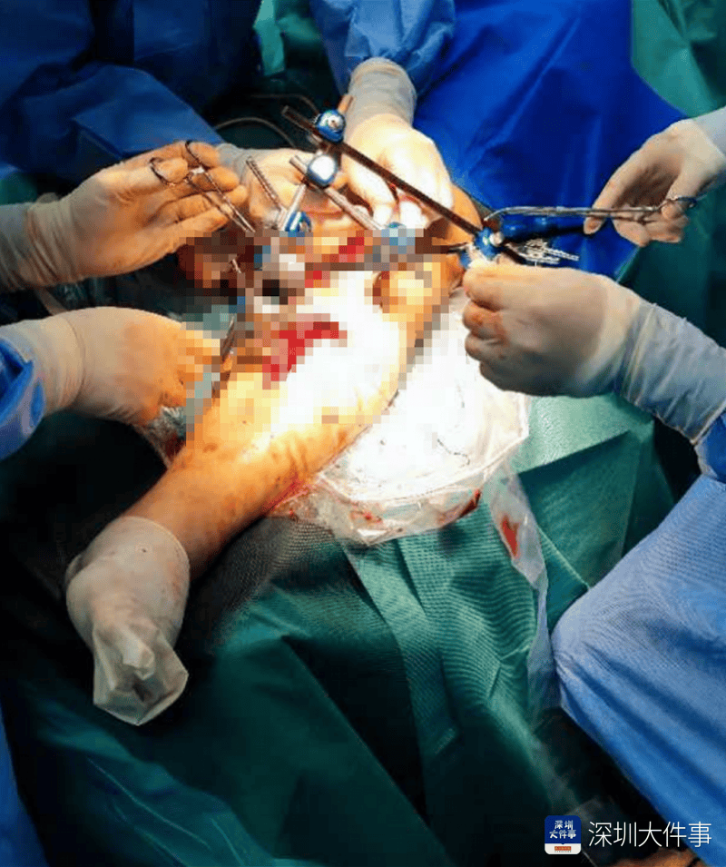 失血过半!深圳男子被三四百斤模具砸到<strong></p>
<p>其他货币资金保证金</strong>,医生全力抢救