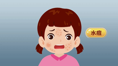 一旦感染终身携带<strong></p>
<p>非货币交易账务处理</strong>！深圳疾控提醒：这4类人要注意