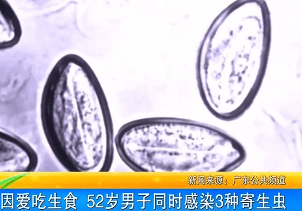 女子体内排出10米长绦虫<strong></p>
<p>basecoin币</strong>！原是两年前旅游时吃了这种食物