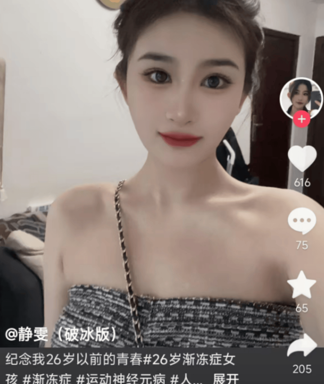 26岁渐冻症女孩去世<strong></p>
<p>如何购买eth币</strong>，生前曾向蔡磊求助，确诊仅1年