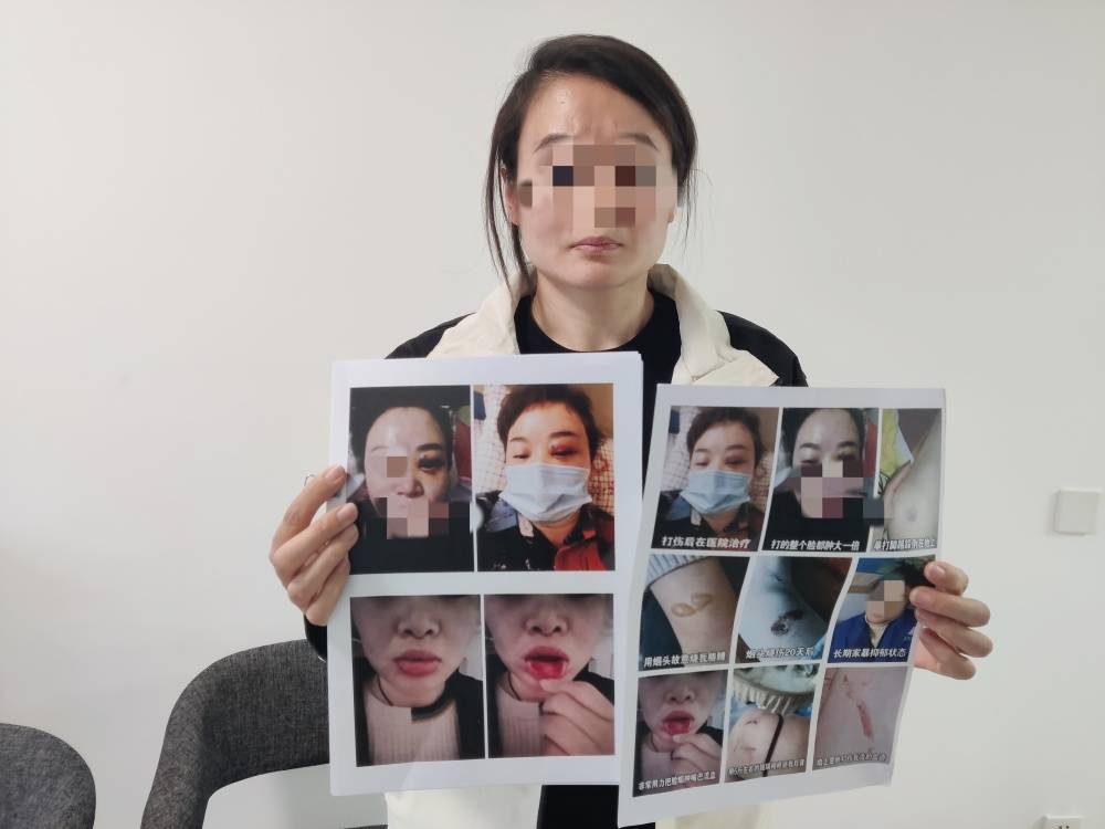 郑州一女子被企业家丈夫家暴最新进展:已要回孩子抚养权