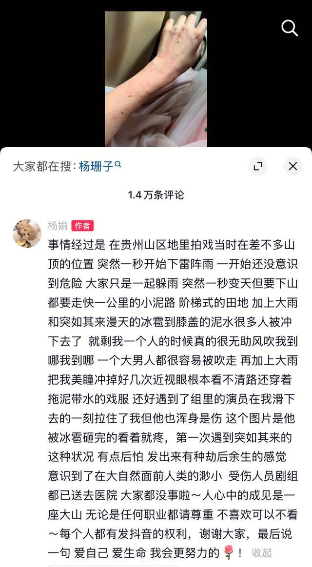女演员贵州拍戏遇极端天气<strong></p>
<p>东莞</strong>，被冰雹砸伤！剧组伤员已送医