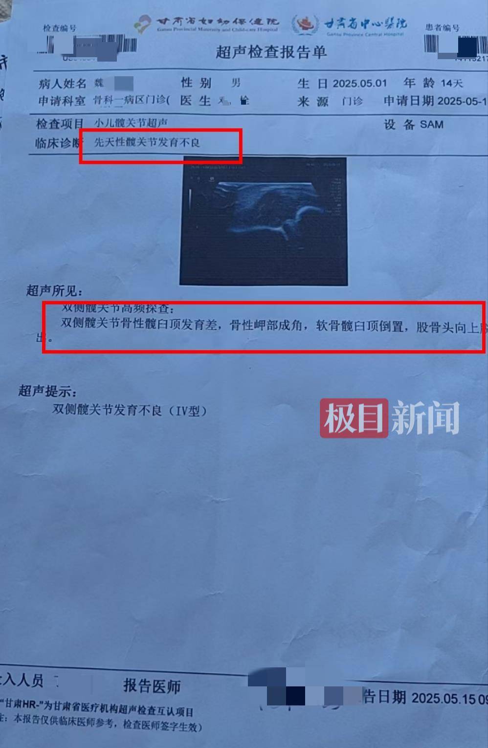 二胎出生查出先天性病症或落下残疾<strong></p>
<p>大饼</strong>，残疾父母称医院产检漏检、未尽告知义务，医院及医调委回应