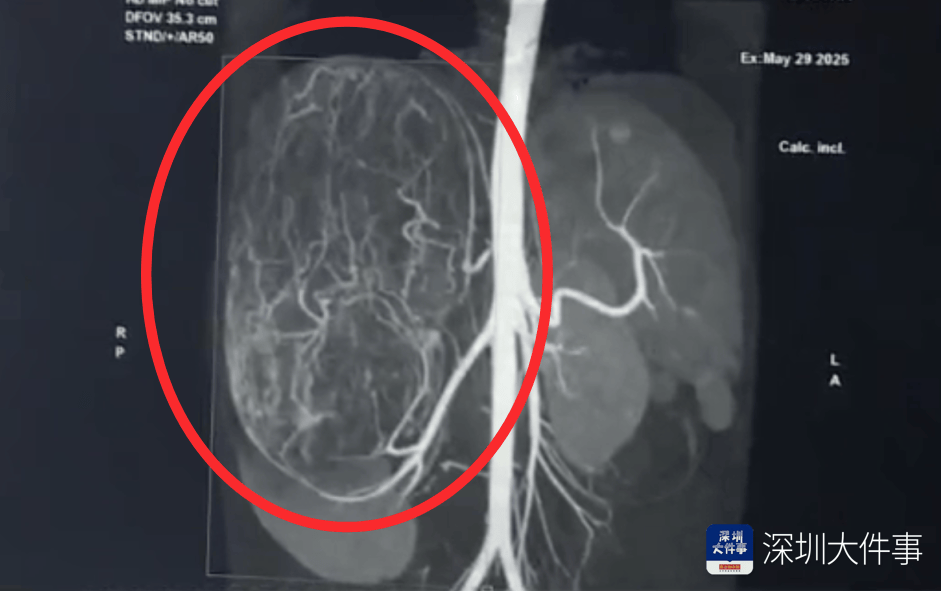 店员试衣间里一句警告<strong></p>
<p>王祖蓝</strong>，竟救了17岁少女！一家人火速赶到深圳