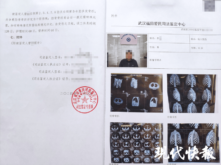 湖北一男子称被交警打断9根肋骨未立案<strong></p>
<p>王宝强</strong>,警方回应