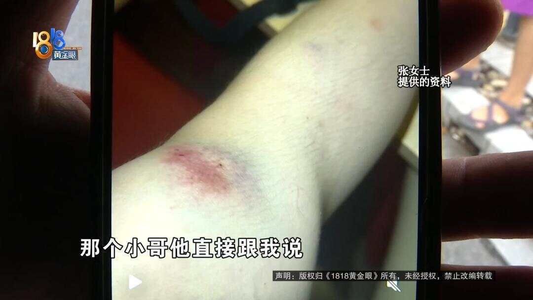 女子下班回家被外卖骑手撞伤 外卖小哥:<strong></p>
<p>LTC</strong>我只有三块钱