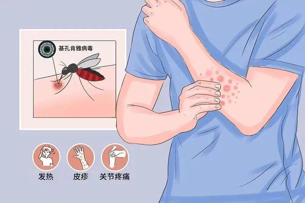 风险增大<strong></p>
<p>okb行情</strong>！深圳疾控：去这247处要小心！张文宏首次发声