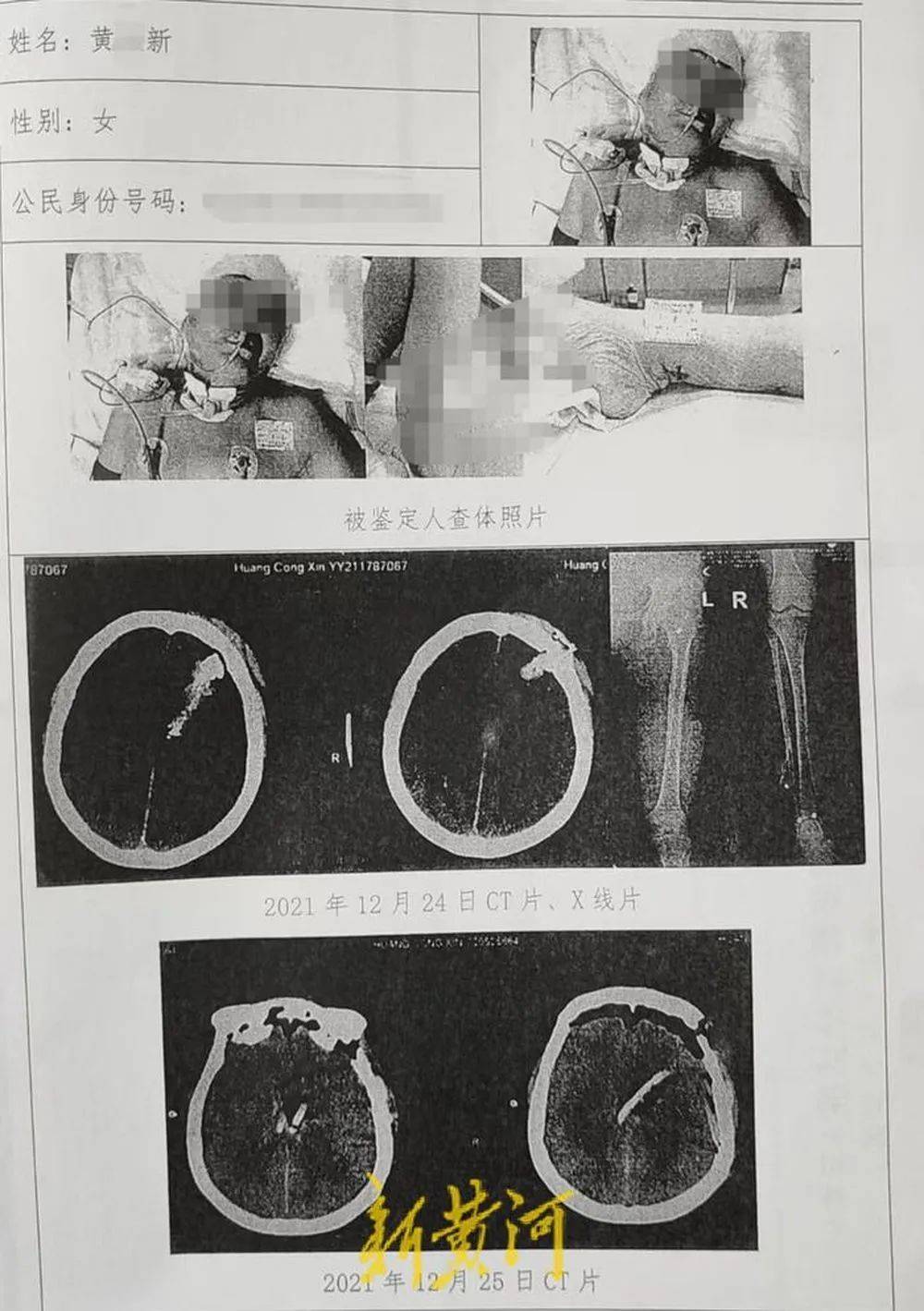 六旬老人遭狩猎者枪击致重伤<strong></p>
<p>SHIB币</strong>，开枪者两次逃离现场，事发4小时后冒充“好心人”施救，家属：耽误了最佳救治时间