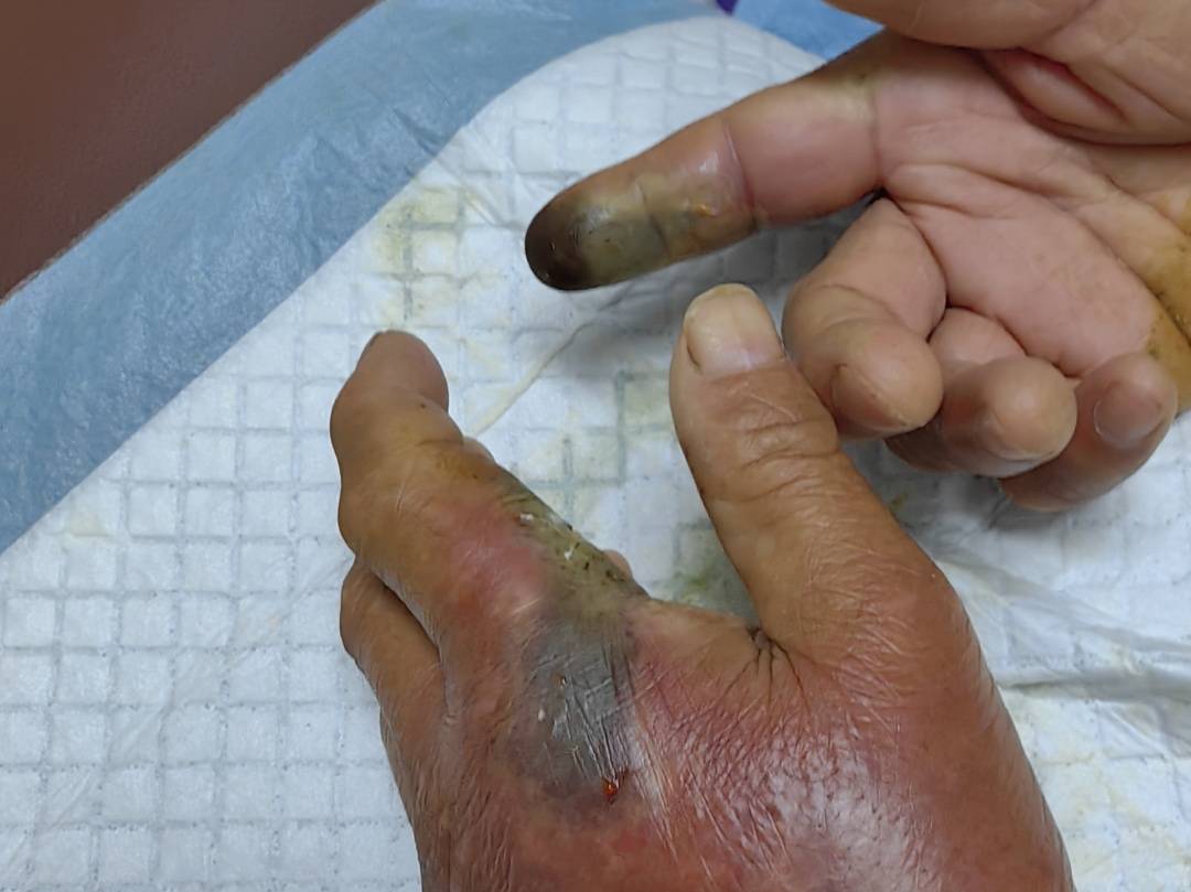 眼镜王蛇咬伤老人<strong></p>
<p>shib币前景</strong>，家属拖两米多长的“凶手”冲进医院！“拎蛇就医”可取吗？