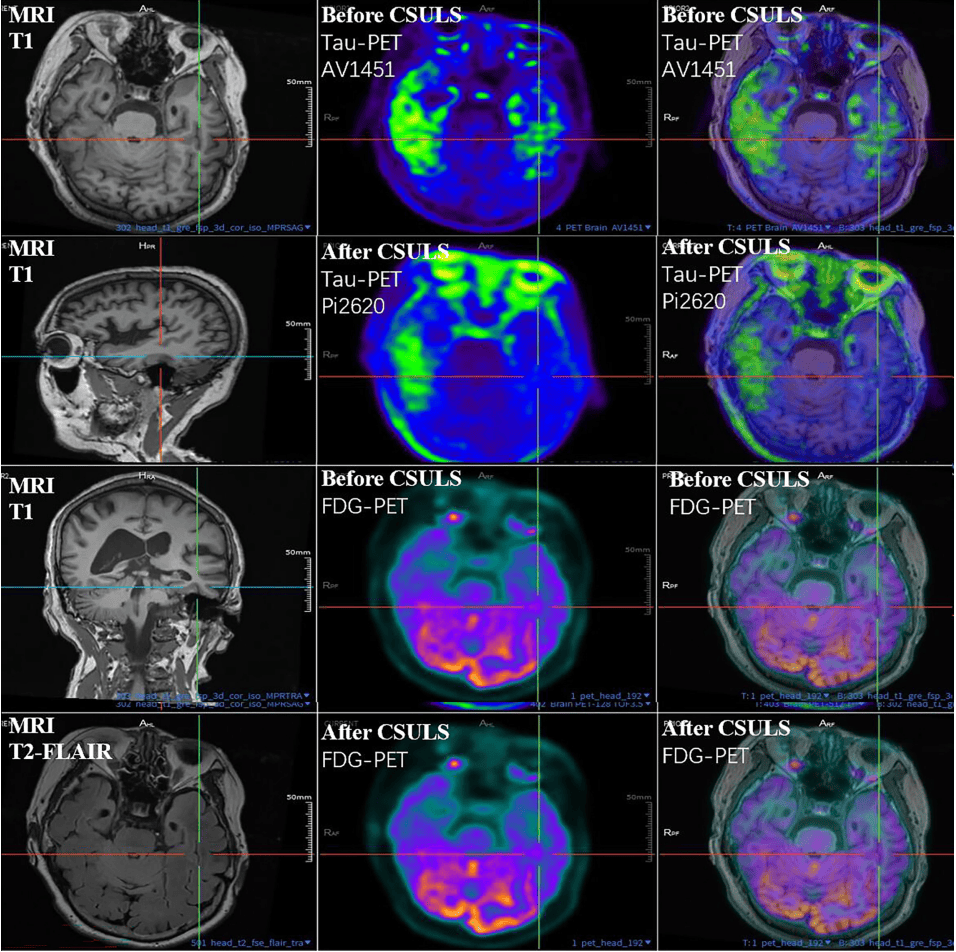 300多家医院抢着做的手术<strong></p>
<p>trx</strong>,为何突被禁?