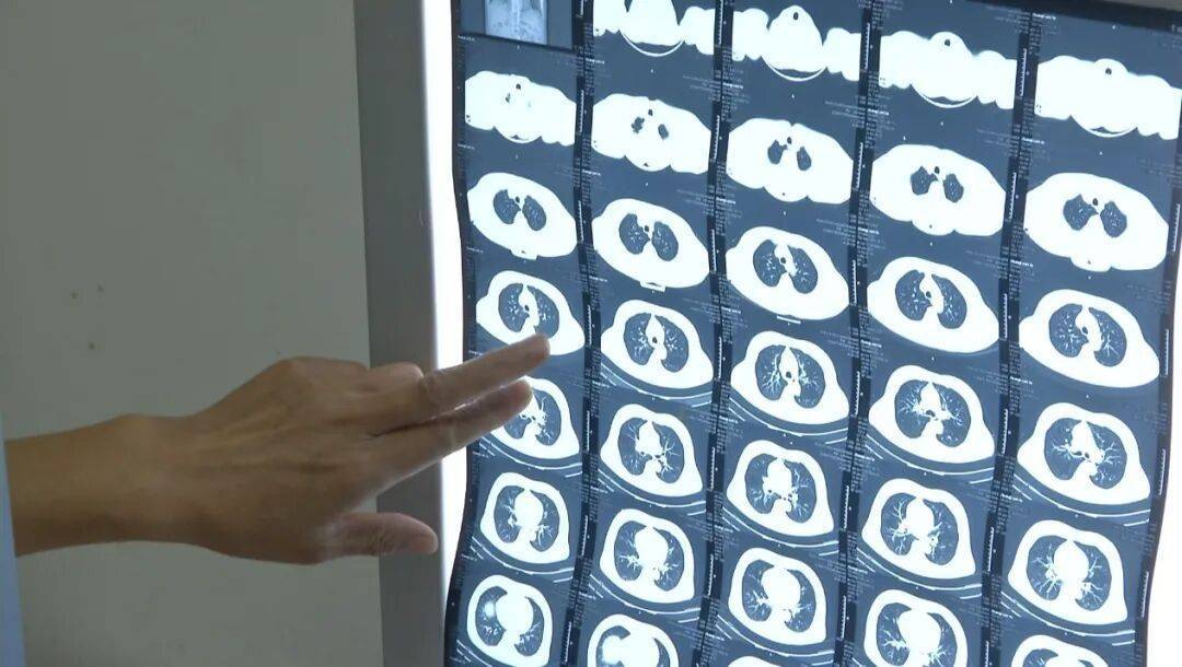 许多患者没有症状<strong></p>
<p>usdt暴跌</strong>,发病就猝死!警惕这种心脏疾病