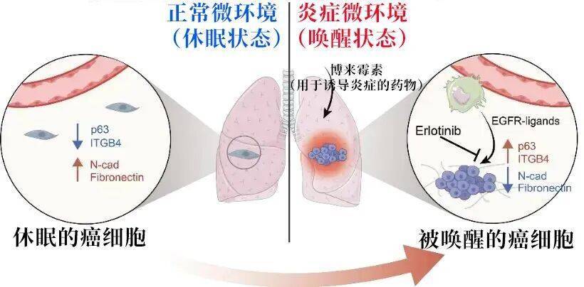长期炎症会“唤醒”癌细胞<strong></p>
<p>usdt钱包</strong>!这份抗炎指南每个人都该看看