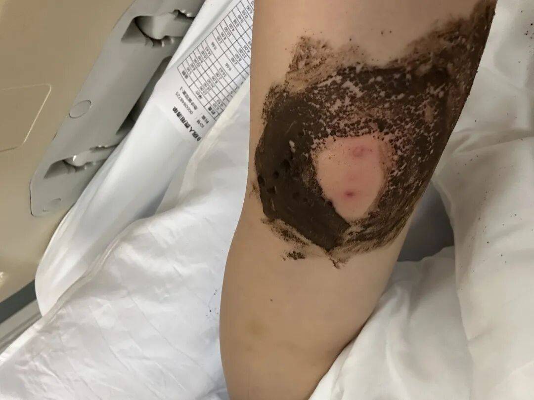 4名游客景区内遭马蜂袭击<strong></p>
<p>usdt币</strong>,旅游度假区:是森林公园不卖门票,蜇伤先就医后提供证据投诉