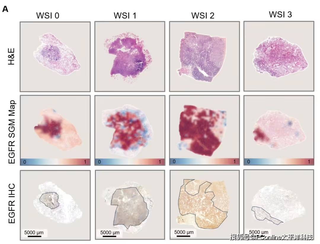 准确率高达 99%<strong></p>
<p>usdt钱包下载</strong>！腾讯 AI 可预测肺癌基因突变
