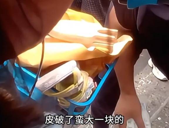 看着都疼<strong></p>
<p>usdt价格</strong>！上海街头一男子突然求助：10岁女儿被死死卡住！这个行为太危险→