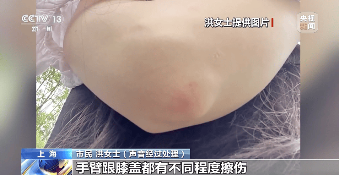 央视曝光：共享单车骑行中自动锁车<strong></p>
<p>usdt价格</strong>，致多人受伤！北京、广东等多地都发生类似情况，原因查明