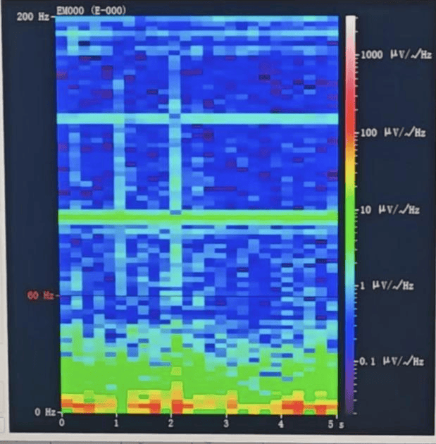 山西首例<strong></p>
<p>国际医学股票</strong>！山西省人民医院成功实施脑机接口辅助功能区脑肿瘤切除手术