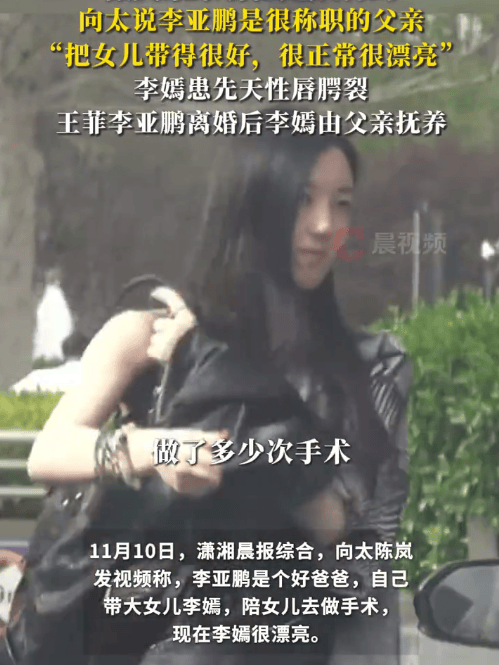 向太说李亚鹏是个好爸爸:<strong></p>
<p>燕京啤酒股票</strong>他自己带大女儿李嫣还陪她做手术