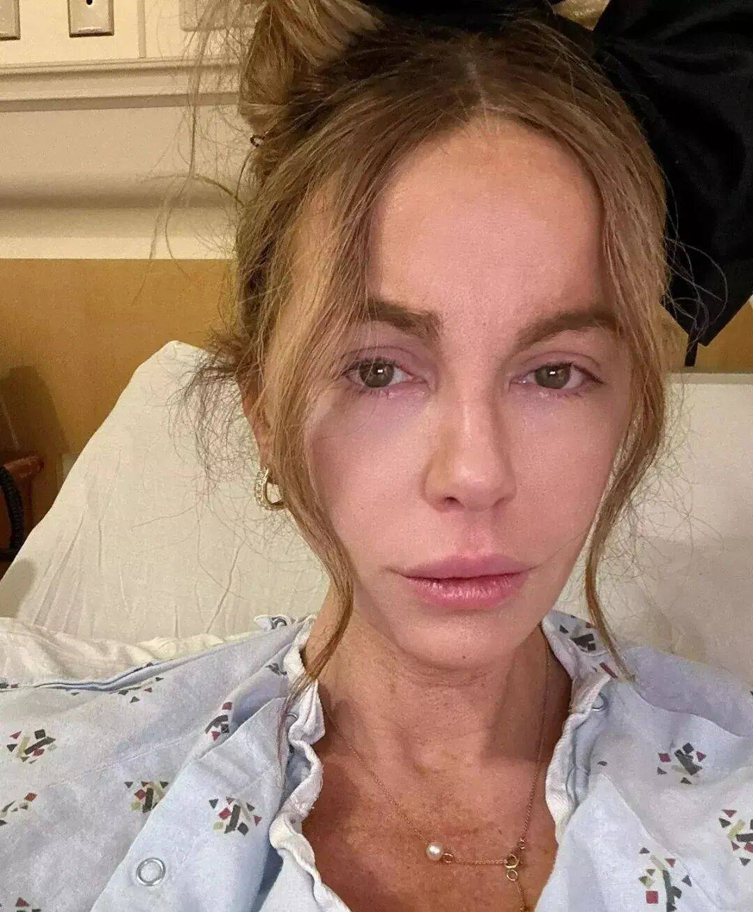 最美吸血鬼如今瘦成骷髅<strong></p>
<p>燕京啤酒股票</strong>？《珍珠港》女主究竟怎么了？